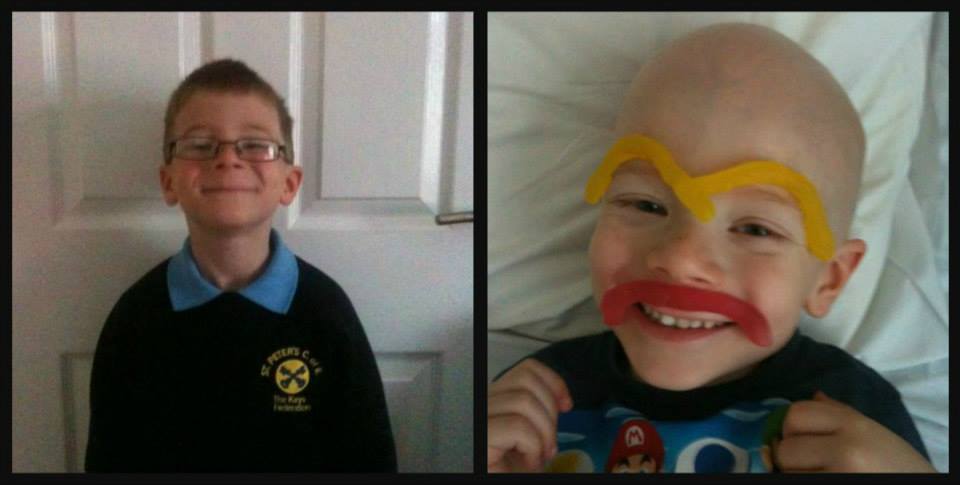 дети больные раком, дети рак до во время после, фото дети рак