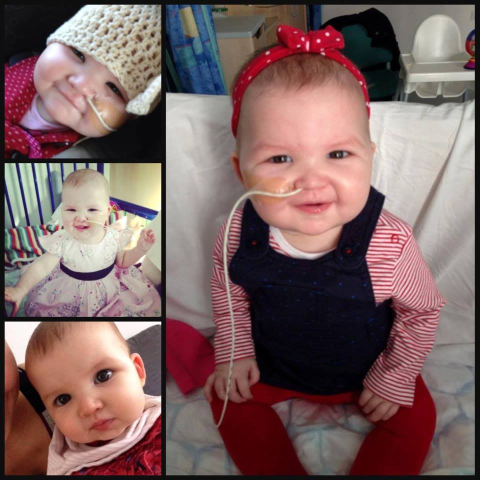 дети больные раком, дети рак до во время после, фото дети рак