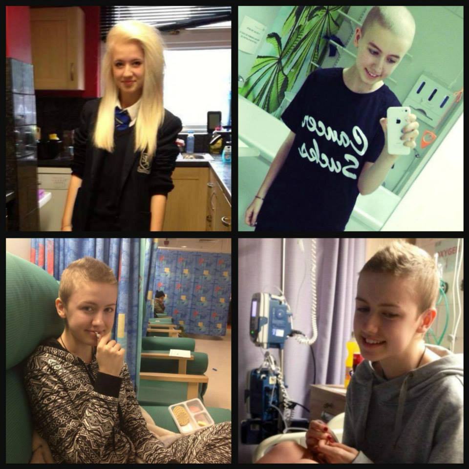 дети больные раком, дети рак до во время после, фото дети рак