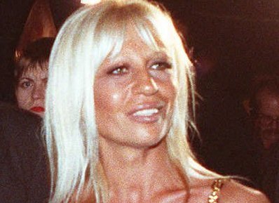 знаменитости до и после пластических операций, звезды Голливуда до и после пластических операций, голливудские знаменитости до и после пластических операций