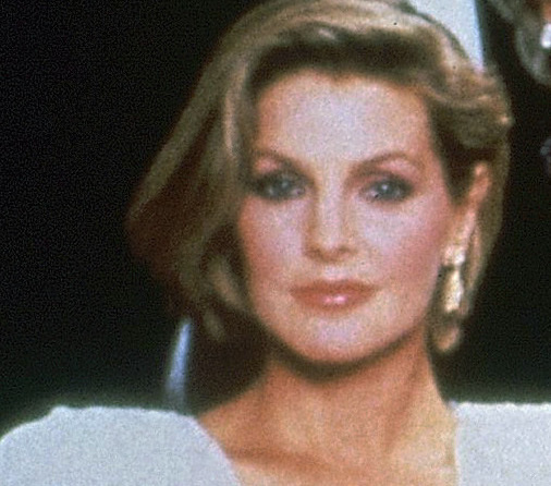 знаменитости до и после пластических операций, звезды Голливуда до и после пластических операций, голливудские знаменитости до и после пластических операций