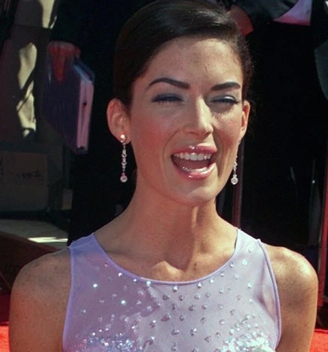 знаменитости до и после пластических операций, звезды Голливуда до и после пластических операций, голливудские знаменитости до и после пластических операций