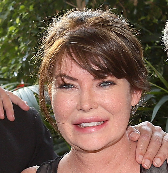 знаменитости до и после пластических операций, звезды Голливуда до и после пластических операций, голливудские знаменитости до и после пластических операций