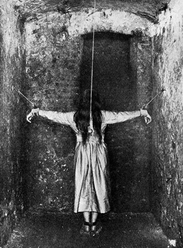 Самые странные и неожиданные методы лечения, которые использовались врачами прошлого врачи прошлого, методы лечения прошлого, странное лечение врачей прошлого