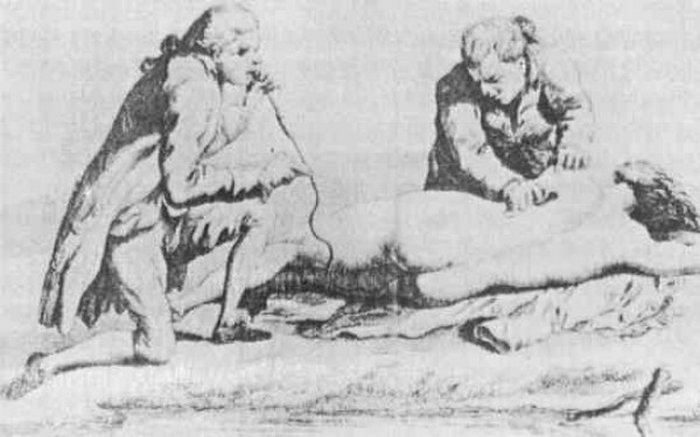 Самые странные и неожиданные методы лечения, которые использовались врачами прошлого врачи прошлого, методы лечения прошлого, странное лечение врачей прошлого