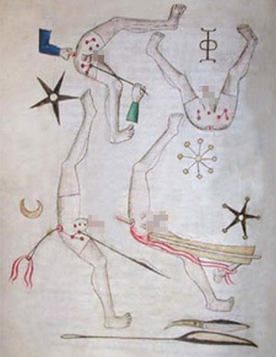 Самые странные и неожиданные методы лечения, которые использовались врачами прошлого врачи прошлого, методы лечения прошлого, странное лечение врачей прошлого