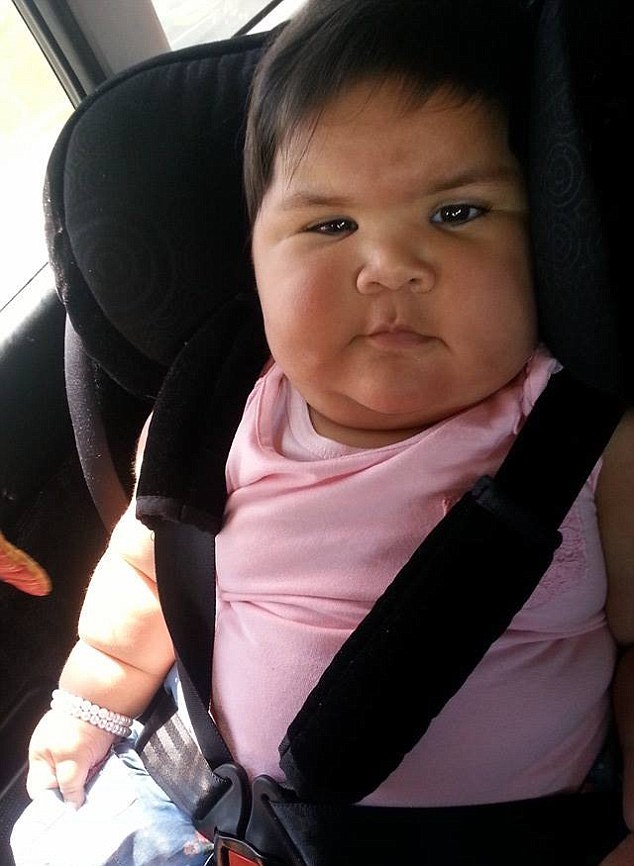 Из-за редкого генетического заболевания 10-месячная малышка выглядит как 5-летний ребёнок Indigo Nowakowsky-Kaiuh, Индиго Новаковски-Каиух, синдром Беквита-Видемана