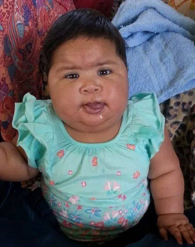 Из-за редкого генетического заболевания 10-месячная малышка выглядит как 5-летний ребёнок Indigo Nowakowsky-Kaiuh, Индиго Новаковски-Каиух, синдром Беквита-Видемана