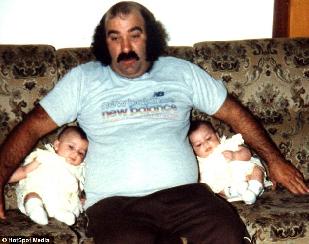 Сёстры-близняшки с одинаковыми пластическими операциями, Lucy Anna DeCinque, до и после