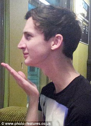 Лицо парня до и после пластической операции по уменьшению носа до и после уменьшения носа, пластическая операция нос, парень уменьшил себе нос