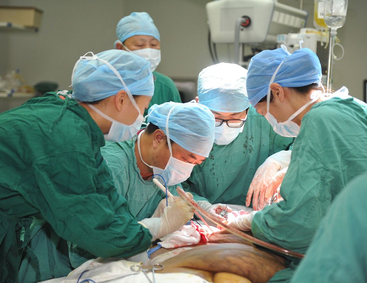 Мужчину с самой большой опухолью в мире избавили от новообразования весом в 108 кг Ян Джанбин Yang Jianbin, самая большая опухоль, опухоль 108 кг