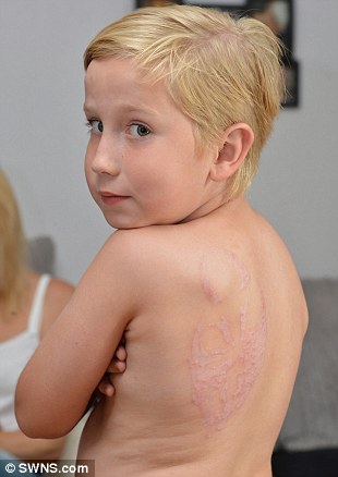 аллергия татуировка хной, мальчик шрам татуировка хной, татуировка лицо Дарта Мола, временная татуировка хной аллергия