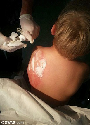 аллергия татуировка хной, мальчик шрам татуировка хной, татуировка лицо Дарта Мола, временная татуировка хной аллергия