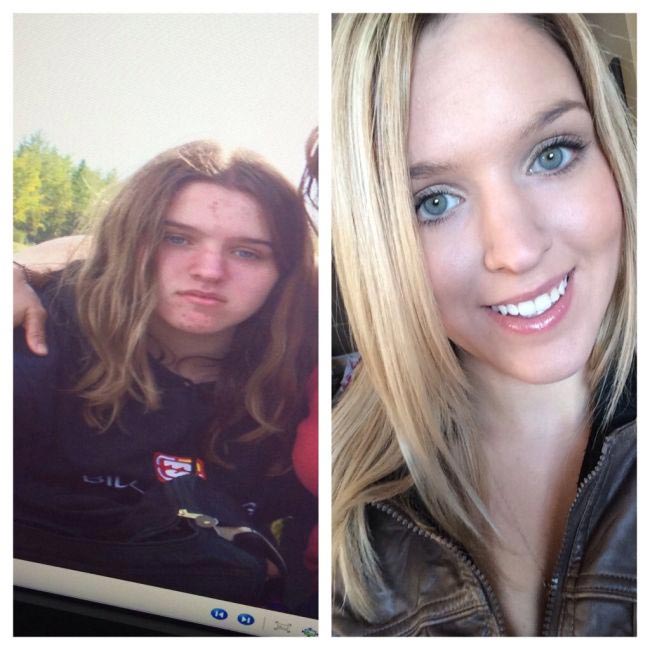 из гадких утят в лебедей, до и после