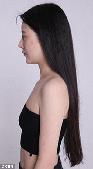 китаянки после пластических операций в Южной Корее, китаянки до и после пластических операций