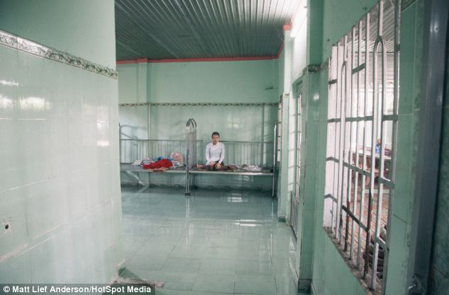 Спустя 50 лет дети продолжают страдать от ужасных последствий использования США химического оружия во Вьетнаме Последствия Agent Orange, война во Вьетнаме, Agent Orange, дети