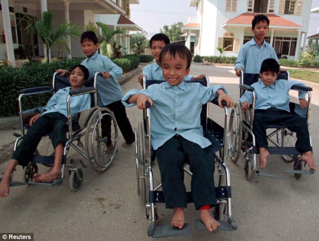 Спустя 50 лет дети продолжают страдать от ужасных последствий использования США химического оружия во Вьетнаме Последствия Agent Orange, война во Вьетнаме, Agent Orange, дети