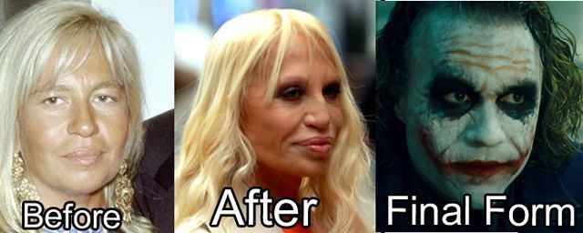 В кого превратятся знаменитости, если не перестанут делать пластические операции звёзды до и после пластических операций, в кого превращаются звёзды, любители пластических операций