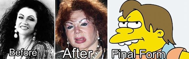 В кого превратятся знаменитости, если не перестанут делать пластические операции звёзды до и после пластических операций, в кого превращаются звёзды, любители пластических операций