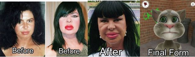 В кого превратятся знаменитости, если не перестанут делать пластические операции звёзды до и после пластических операций, в кого превращаются звёзды, любители пластических операций