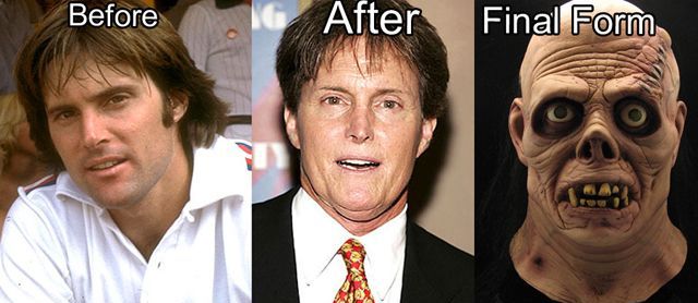 В кого превратятся знаменитости, если не перестанут делать пластические операции звёзды до и после пластических операций, в кого превращаются звёзды, любители пластических операций