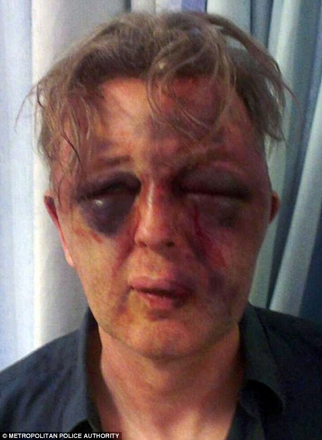 лицо ученого после избиения, ученого избили грабители в его доме, лицо ученого реконструктивная хирургия