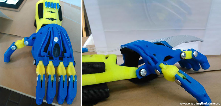 3D-printed hand Aaron Brown, детские 3D протезы в виде рук супергероев
