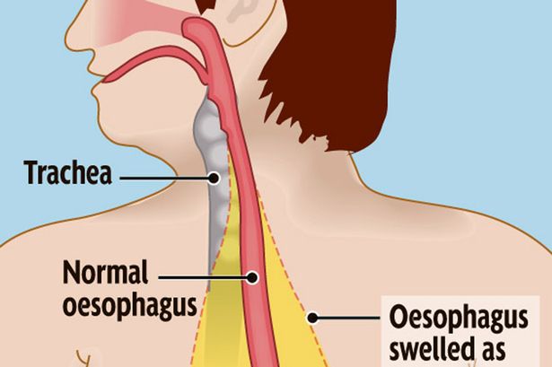 премия дарвина, нелепые смерти, удостоившиеся премии дарвина