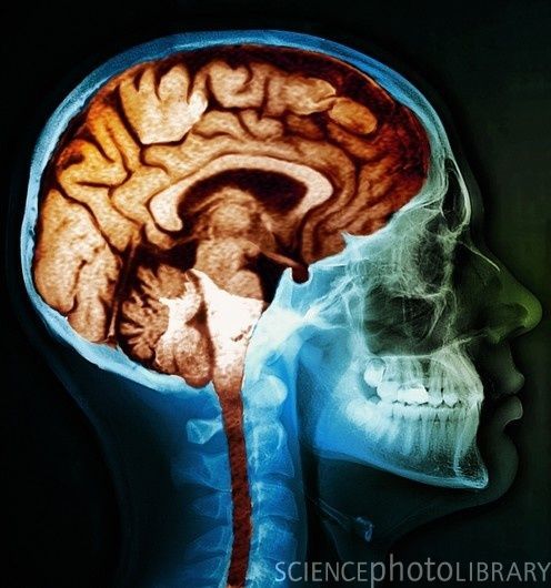 15 полезных и познавательных коротких фактов о нашем мозге полезные факты о мозге, короткие факты, интересные факты о мозге