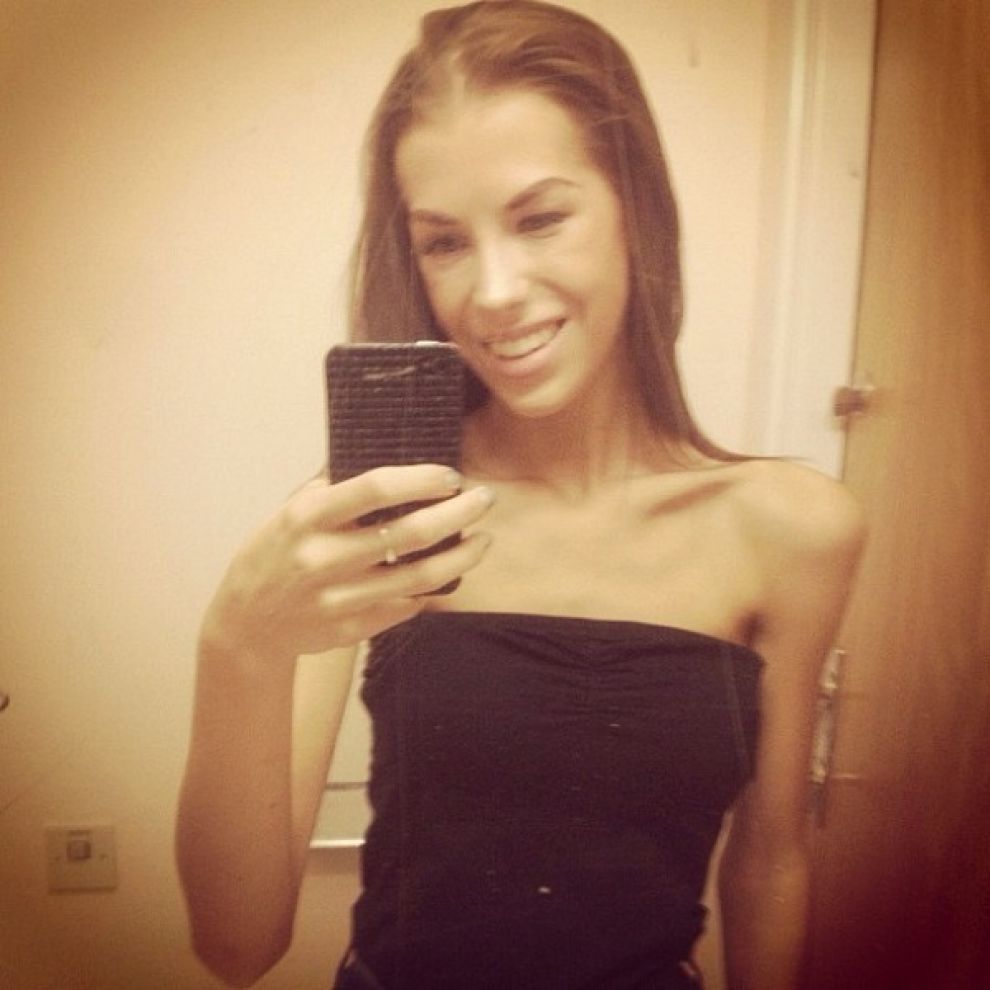 Instagram, Антония Эрикссон, анорексия, до и после