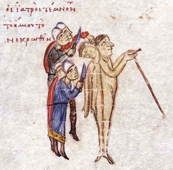 истории о сиамских близнецах, сиамские близнецы, сросшиеся