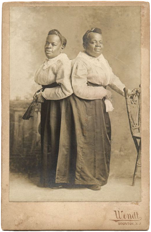 Сиамские близнецы истории и фото