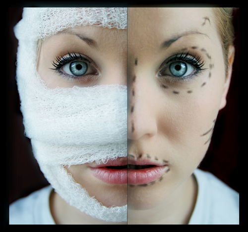 помешанные на пластических операциях, неудачные пластические операции, самые необычные пластические операции 