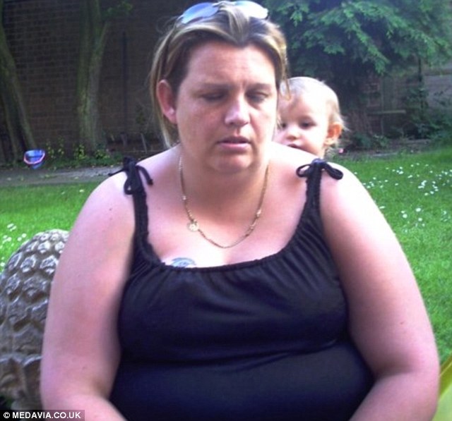 похудела на 63,5 кг, похудела своими силами, отказали в операции на желудке