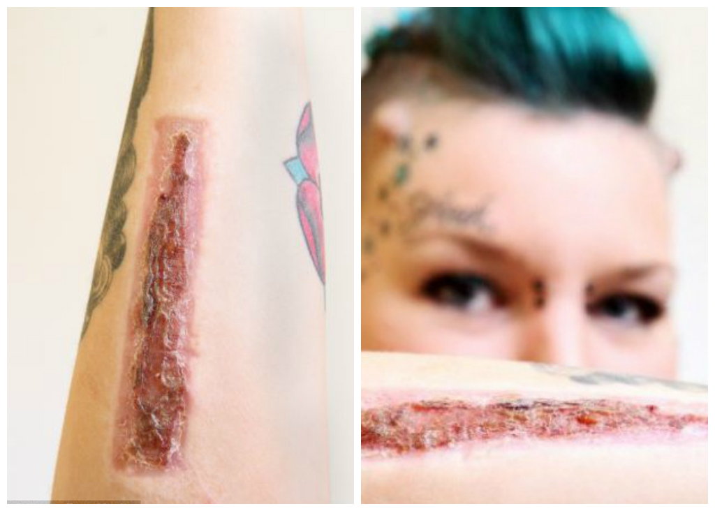 Торз Рейнольдс, Torz Reynolds, срезала татуировку, экс-бойфренд,