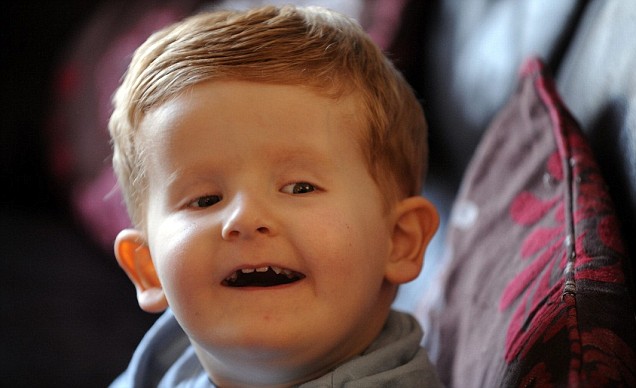 истории, люди, родились, с лишними частями, тела, органами