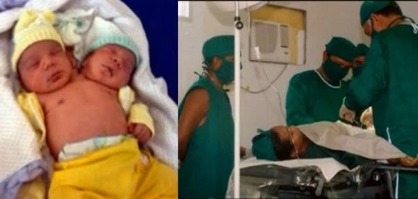 истории, люди, родились, с лишними частями, тела, органами