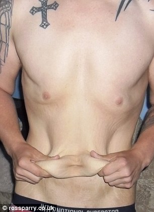 отказано в удалении лишней кожи, похудел на 108 кг, после похудения набрал мышцы,  Джейкоб Хорнер, Jacob Horner