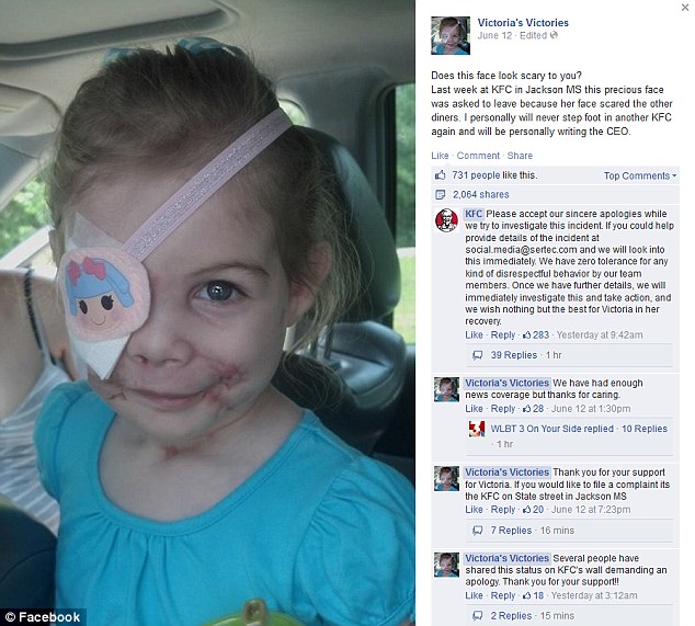 3-летнюю девочку, изуродованную питбулями, выгнали из закусочной, из-за её внешности девочку выгнали из-за внешности, на девочку напали 3 питбуля, девочку выгнали из KFC, Виктория Уилчер, Victoria Wilcher