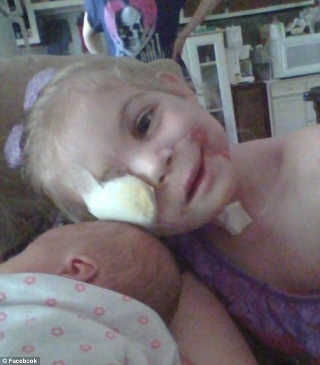 3-летнюю девочку, изуродованную питбулями, выгнали из закусочной, из-за её внешности девочку выгнали из-за внешности, на девочку напали 3 питбуля, девочку выгнали из KFC, Виктория Уилчер, Victoria Wilcher