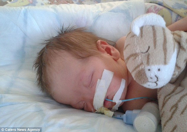 Tessa Evans Тесса Эванс, девочка без носа, аплазия