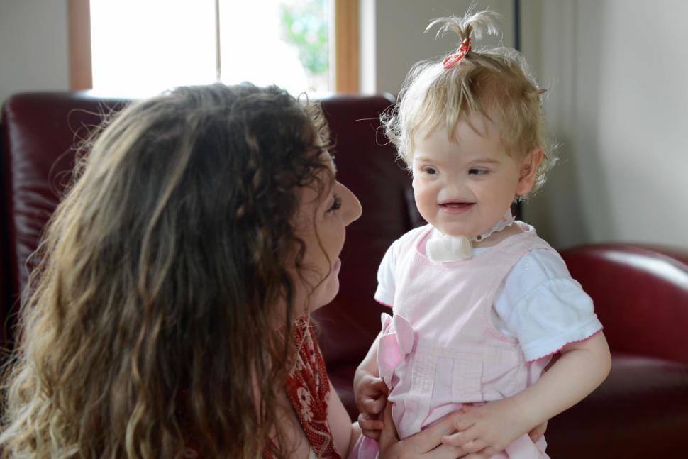 Tessa Evans Тесса Эванс, девочка без носа, аплазия