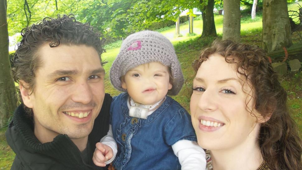 Tessa Evans Тесса Эванс, девочка без носа, аплазия