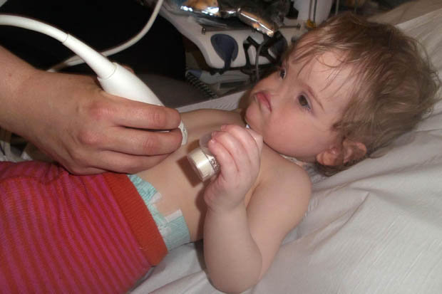 Tessa Evans Тесса Эванс, девочка без носа, аплазия