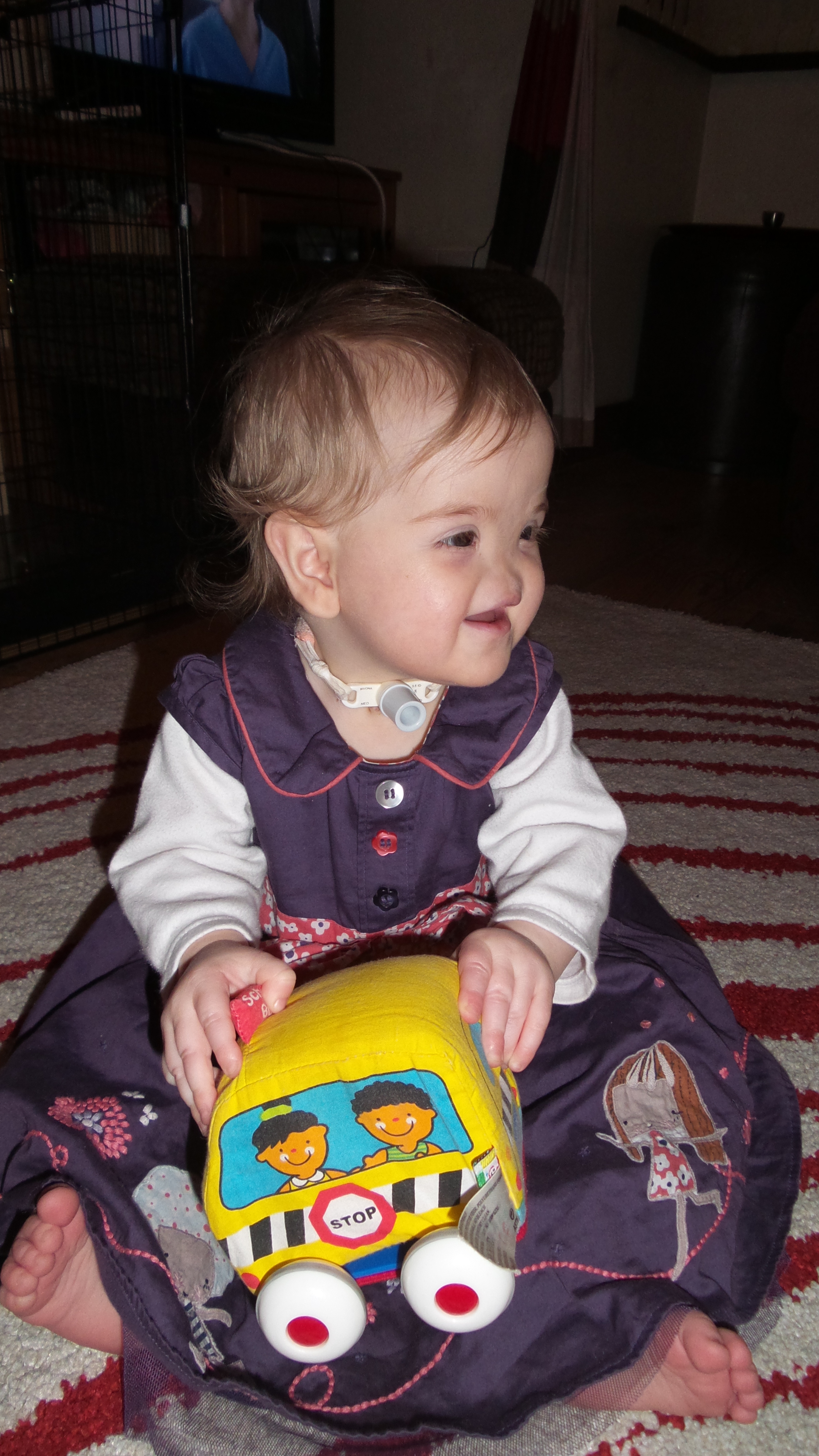 Tessa Evans Тесса Эванс, девочка без носа, аплазия