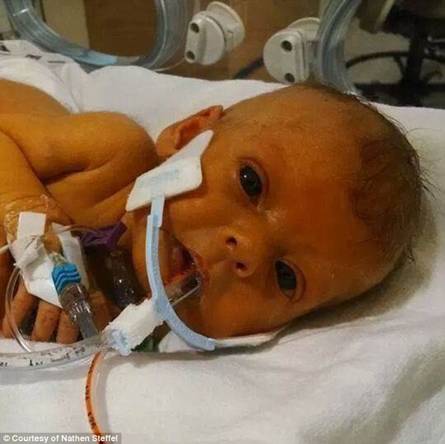 дочь без медицинских трубок, отец попросил убрать трубки дочь, умерла дочь София медицинские трубки, Натан Стэффел, Nathan Steffel