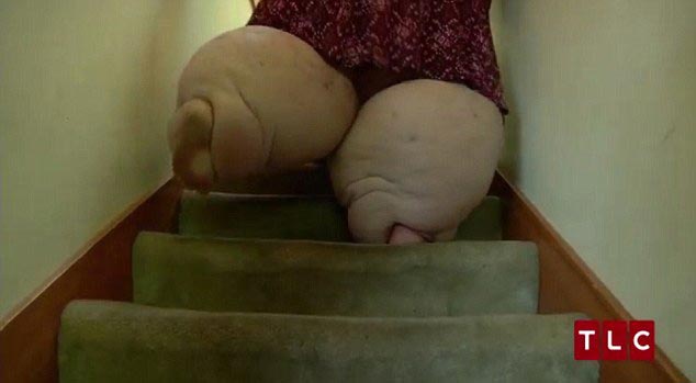 My 600-lb Life Amber, шоу My 600-lb Life на TLC, жизнь 300-килограммовой девушки