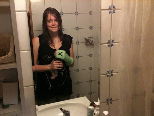 креативный гипс, необычные творческие повязки, разрисованный гипс, рисунки на гипсе