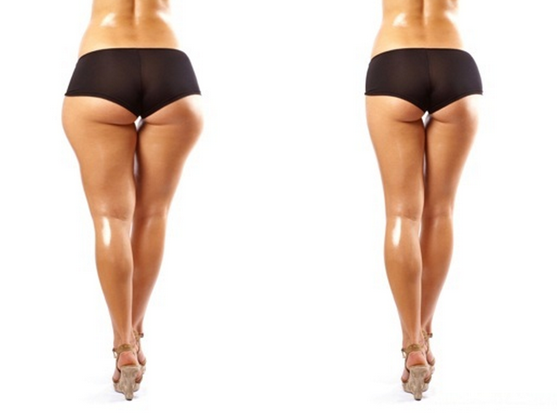 20 самых смешных и нелепых поисковых запросов касаемо похудения смешные запросы, нелепые глупые запросы похудение