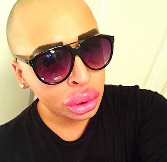 Джеймс Парк,James Parke, фанат Ким Кардашьян, мужчина превратился в Ким Кардашьян, парень сделал операции Ким Кардашьян